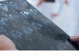 Uzavření neurologické ambulance od 12. 8. do 16. 8. 2024