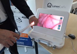 Nadační fond S námi je tu lépe! představil v Orlickoústecké nemocnici nový endoskop i plány do budoucna